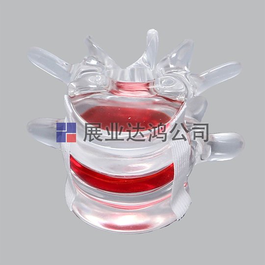 SAWBONES 腰椎L4-L5解剖透明模型1701-251
