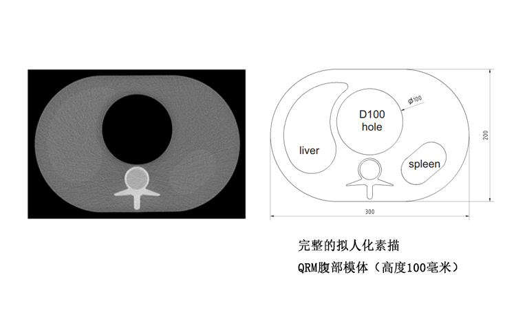 德國QRM 腹部模體
