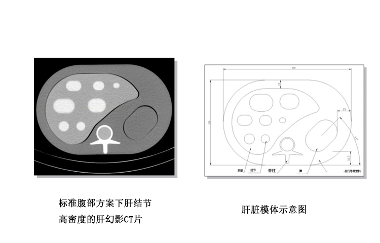 德國QRM 半擬人化肝臟模體