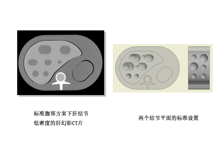 德國QRM 半擬人化肝臟模體
