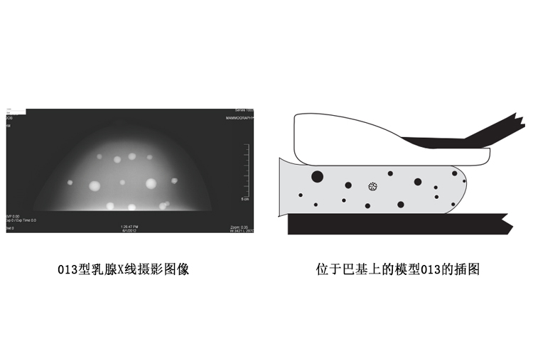 美國cirs 013立體定向穿刺活檢體模體