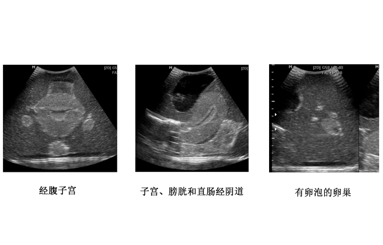 美國cirs 404A女性超聲骨盆模體