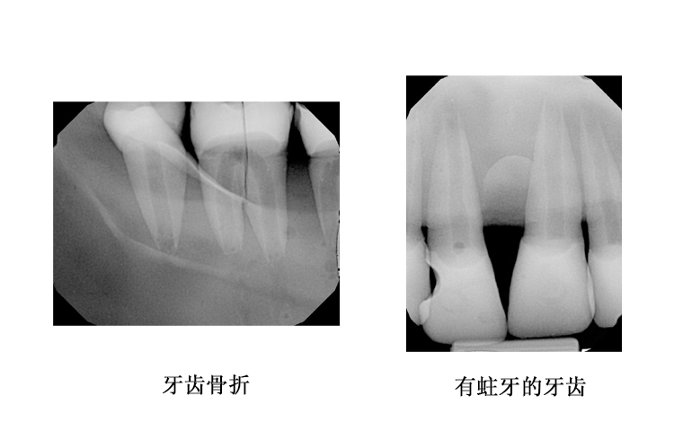 美國cirs 134200牙科模體
