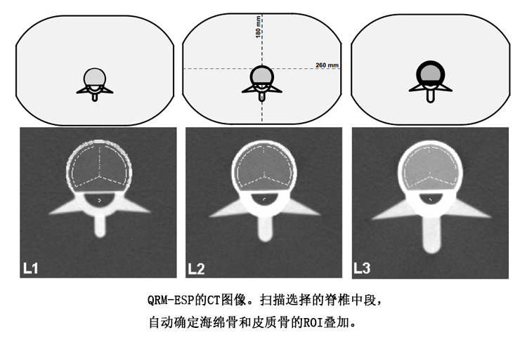 德國QRM ESP歐洲脊柱模體